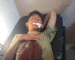 Badan Eksekutif Mahasiswa (BEM) Sekolah Tinggi Agama Islam (STAI) Al-Amin Dompu angkat bicara terkait insiden pelemparan batu oleh sekelompok remaja tak dikenal yang terjadi di Kelurahan Karijawa, Kecamatan Dompu, Kabupaten Dompu, pada Minggu (4/8/2025).