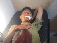 Badan Eksekutif Mahasiswa (BEM) Sekolah Tinggi Agama Islam (STAI) Al-Amin Dompu angkat bicara terkait insiden pelemparan batu oleh sekelompok remaja tak dikenal yang terjadi di Kelurahan Karijawa, Kecamatan Dompu, Kabupaten Dompu, pada Minggu (4/8/2025).